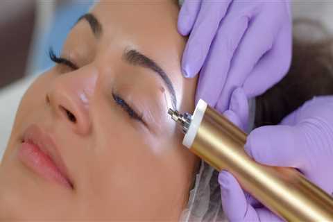 Chemical treatments for Mole Removal Procedures