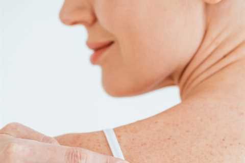 Types of Surgical Mole Removal