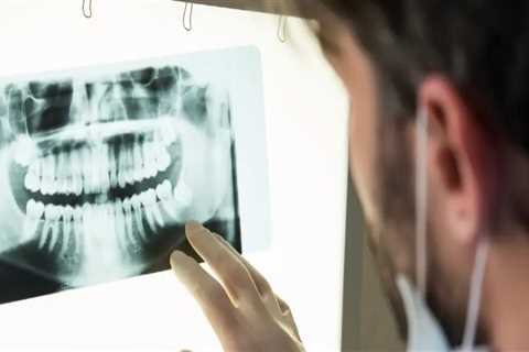 Understanding The Importance Of Dental X-Rays Before Getting A Dental Implant In Georgetown