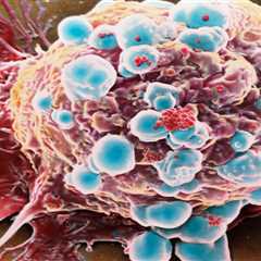 The 13 red-flag cancer symptoms you should get checked out now revealed