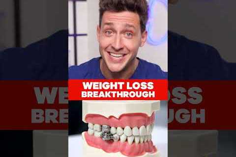 Shut Your Mouth For Weight Loss