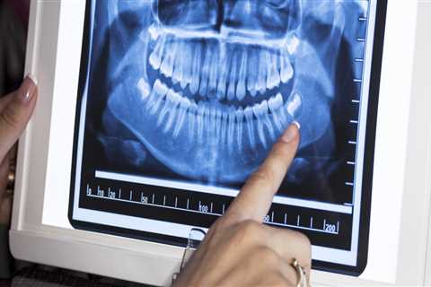 What Is The Importance Of Dental X-Rays In Dentistry In Austin, TX