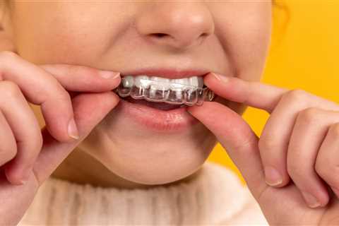 An Orthodontist And A Dentist: What Are The Differences? | Home Mum