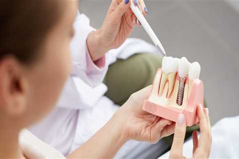 Post-Treatment Care For Your Dental Implant: What You Need To Know In Georgetown And Austin