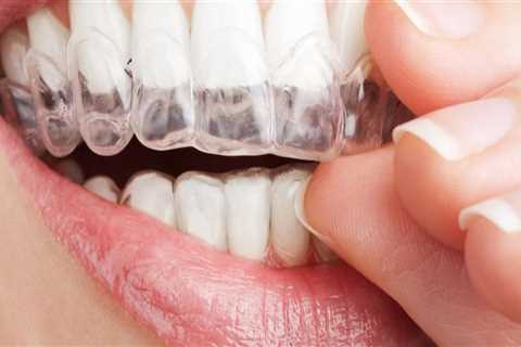 What comes under dental cosmetics?