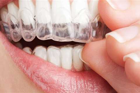 Do Invisible Aligners Really Work?