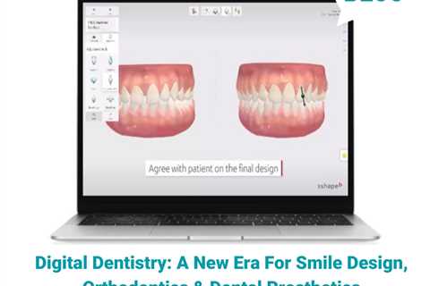 Standard post published to Smalto Dental Clinic at March 22, 2023 10:00