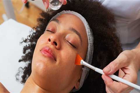 Chemical Peels: A Comprehensive Overview