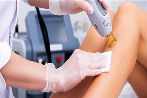 Laser Hair Removal Services: Everything You Need to Know
