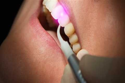 What to Avoid After Laser Dental Treatment