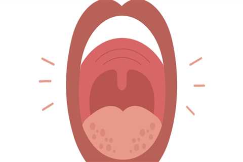 Can Dental Allergies Cause Swelling of the Lips or Tongue?