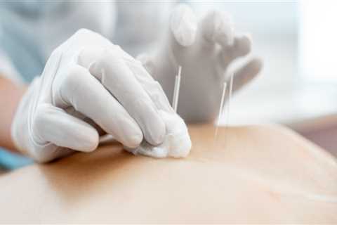 Acupuncture: An Overview of Benefits, Techniques and Treatments