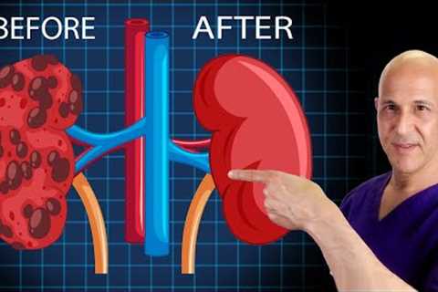 How to Heal & Cleanse Your KIDNEYS!  Dr. Mandell