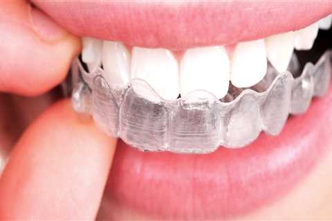 Do Clear Aligners Work as Well as Braces?