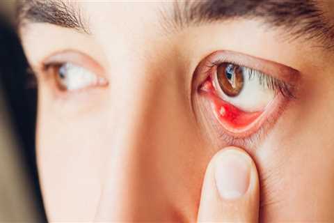 Eye Problems: An Overview of Symptoms, Causes, and Treatments