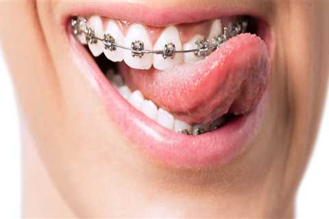 What Do Orthodontists Do on a Daily Basis?