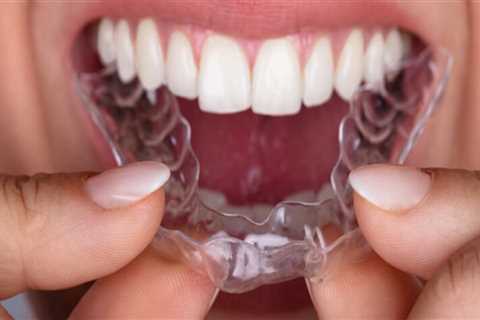 Achieving A Confident Smile: The Benefits Of Invisalign Clear Braces In Georgetown