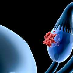 Ovarian Cancer Trial to Study IMNN-001, Chemotherapy Combination