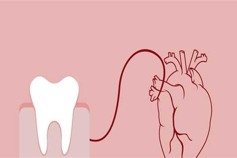 Why is dental work important?