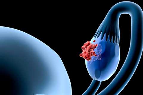 Ovarian Cancer Trial to Study IMNN-001, Chemotherapy Combination