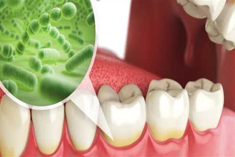 What are the types of oral hygiene?