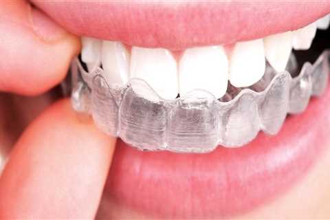 What To Expect During Invisalign Dental Treatment As Part Of Your Preventive Health Care Plan In..