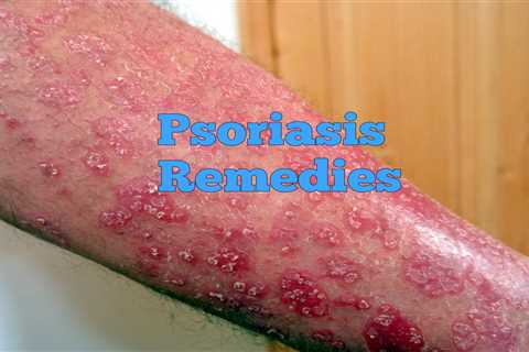 10 Home Remedies for Psoriasis - Home Remedies App