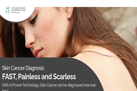 Painless, Scarless and Minimally Invasive Mole Removal Laser Procedure