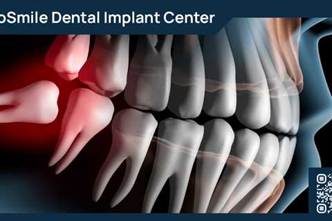 Standard post published to ProSmile Dental Implant Center at June 07, 2023 16:01