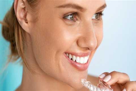 Invisible Orthodontics: Transforming Smiles With Invisalign Clear Braces In Woden