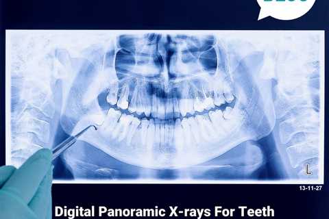 Standard post published to Smalto Dental Clinic at June 26, 2023 10:00