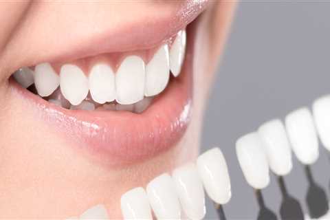 Why Teeth Whitening Is An Important Part Of Preventive Health Care In London