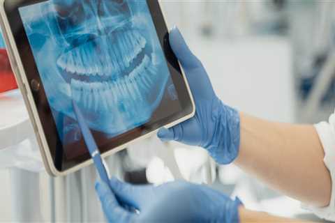 Why Dental X-rays Are Essential For Your Oral Health: Insights From A Spring Branch Dentist