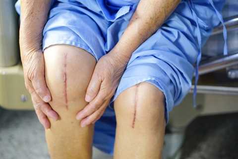 Alternatives to Knee Replacement Surgery