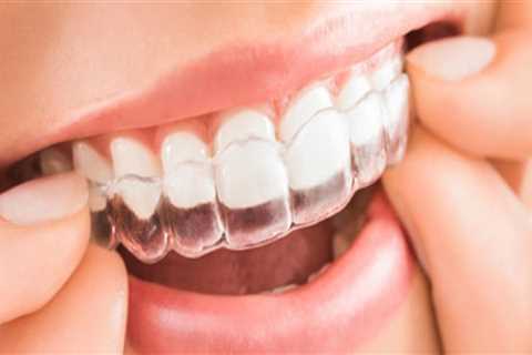 What Are the Risks of Invisalign Treatment from a Dentist?