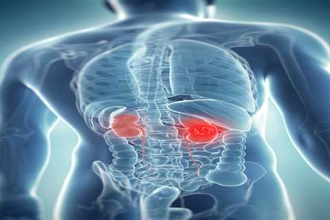 The ‘silent’ symptom of killer kidney cancer that strikes at night – and 6 other signs you must..