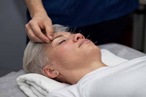 Facial Acupuncture Training Course