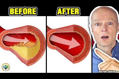 Only A Glass Of This Juice… Reverse Clogged Arteries & Lower High Blood Pressure – Doctor Reacts