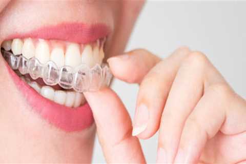 Get a Free Consultation with an Invisalign Dentist Before Making a Decision