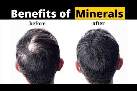 Why minerals are important for health | benefits of minerals | Dietician Awais Shahzada