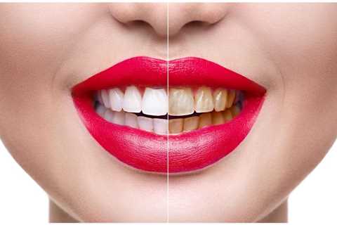 Unlock Your Best Smile: All About Cosmetic Dentistry