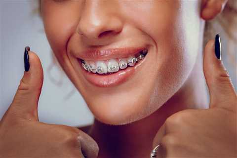 Understanding the Different Types of Orthodontic Appliances and How They Work