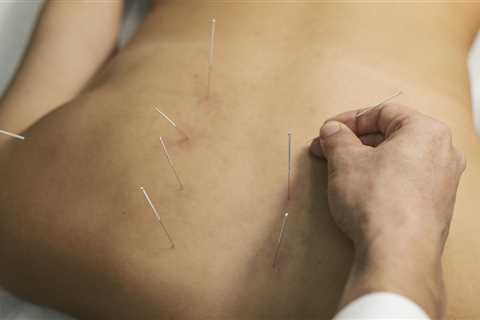 Acupuncture Centre Reading Training Days