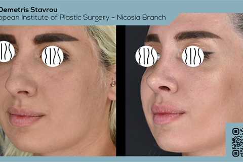 Standard post published to Dr. Demetris Stavrou - European Institute of Plastic Surgery - Nicosia..