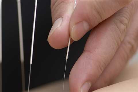 When is Acupuncture Not Safe? A Comprehensive Guide