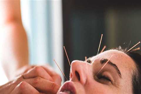 What are the Side Effects of Acupuncture Treatment?