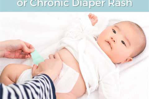 How to Heal Severe or Chronic Diaper Rash