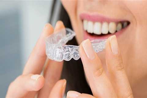 Invisalign Clear Braces: The Modern Solution Provided By South Riding Dentists