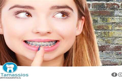 Standard post published to Tamassios Orthodontics - Orthodontist Nicosia, Cyprus at September 30,..