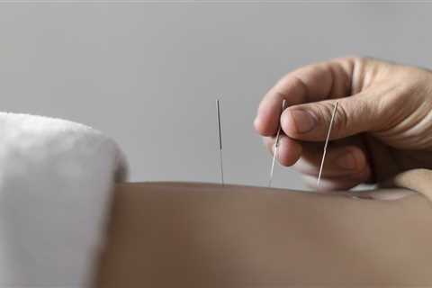 ACUPUNCTURE FOR WEIGHT LOSS: MYTH OR REALITY?